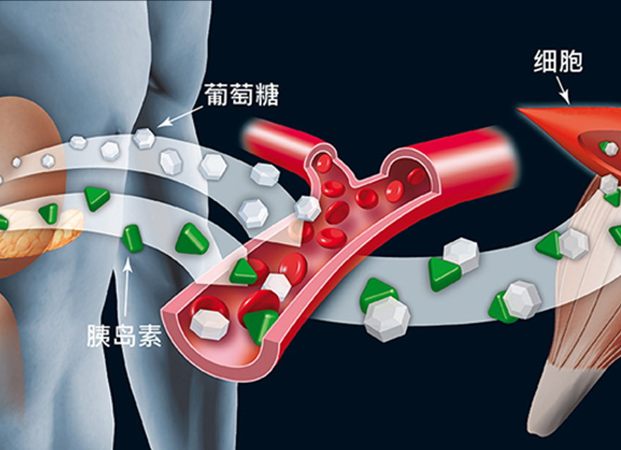 瑞特教你认识糖尿病